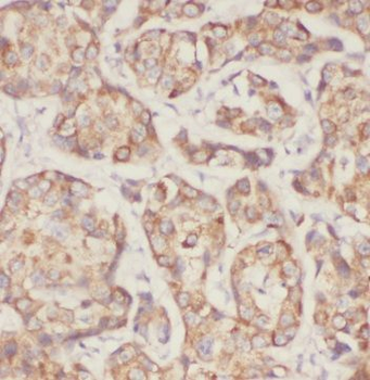 MRPL49 Antibody