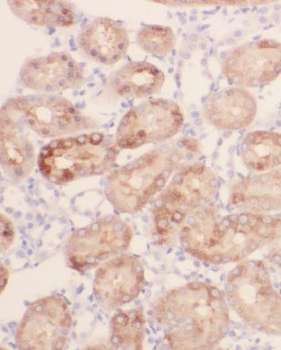 MRPL52 Antibody