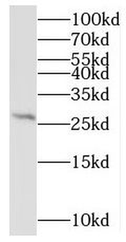 MRPL9 Antibody