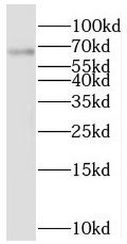 Prorp Rabbit Polyclonal Antibody