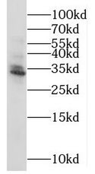 MRPS2 Antibody