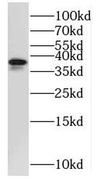 MRPS31 Antibody