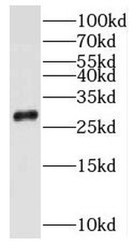 MRRF Antibody