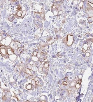 MRRF Antibody