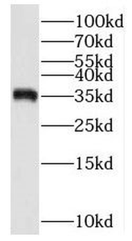MS4A12 Rabbit Polyclonal Antibody