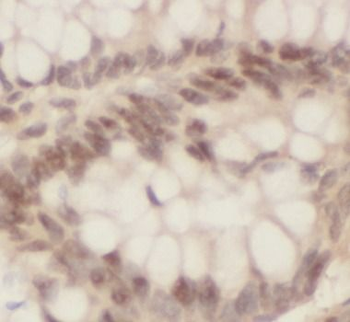 MSH2 Antibody