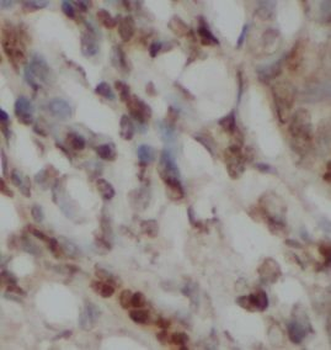 MSH2 Mouse Monoclonal Antibody