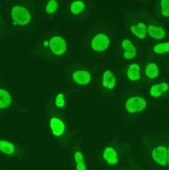 MSH6 Antibody