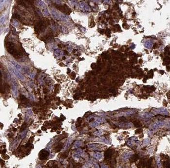 MSI2 Antibody