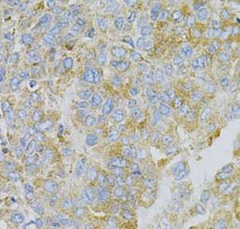 MSN Rabbit Polyclonal Antibody