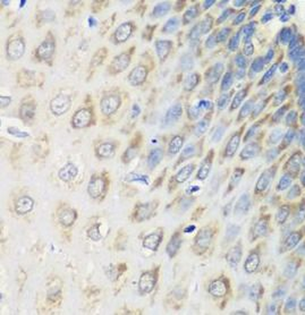 MSRB2 Antibody