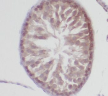 MSRB3 Antibody