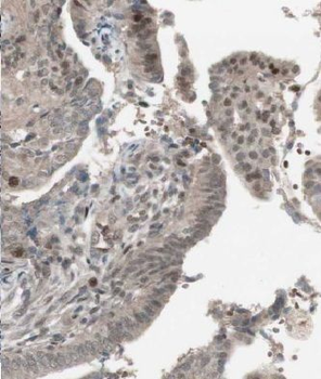 YBX2 Antibody