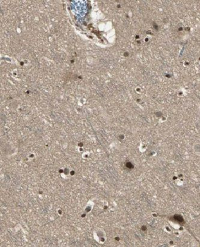 MT3 Rabbit Polyclonal Antibody