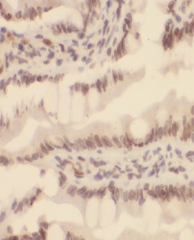 MTA2 Antibody