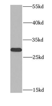 MTAP Rabbit Polyclonal Antibody