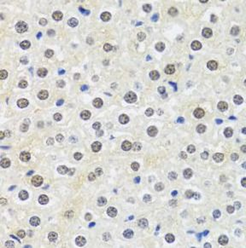 MTAP Rabbit Polyclonal Antibody