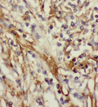 NUDT1 Antibody