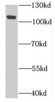 MTHFD1L Antibody