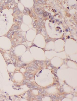 MTHFD2 Antibody