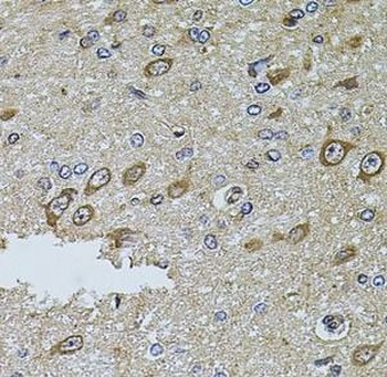 MTIF3 Antibody