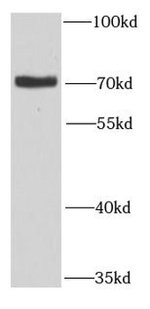 MTMR14 Antibody