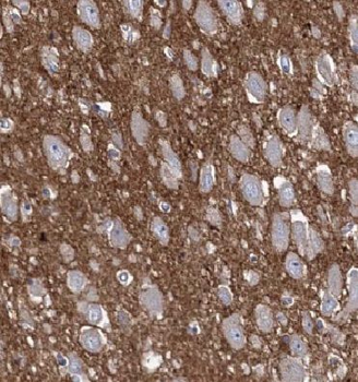 MTMR14 Antibody