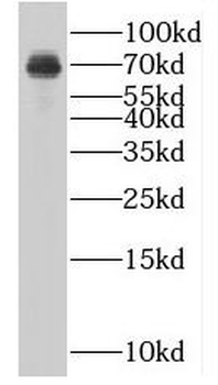 MTMR2 Rabbit Polyclonal Antibody
