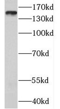 MTMR3 Rabbit Polyclonal Antibody