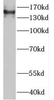 MTMR4 Rabbit Polyclonal Antibody