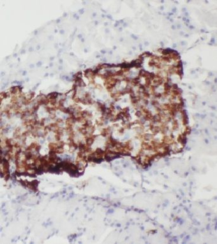 MTR Antibody