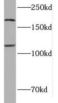 MTUS1 Antibody
