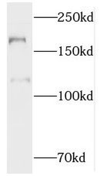 MTUS1 Antibody