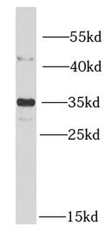 MTX1 Antibody