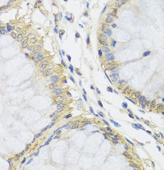 MTX1 Antibody