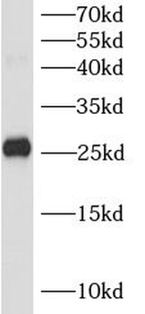 MUC1 Rabbit Polyclonal Antibody
