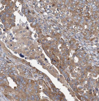 MUC1 Rabbit Polyclonal Antibody