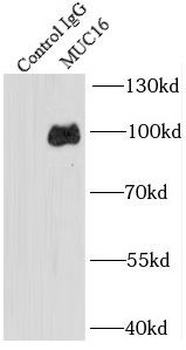 MUC16 Antibody