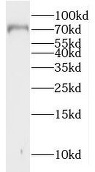 MUC20 Rabbit Polyclonal Antibody