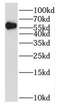MUTYH Rabbit Polyclonal Antibody