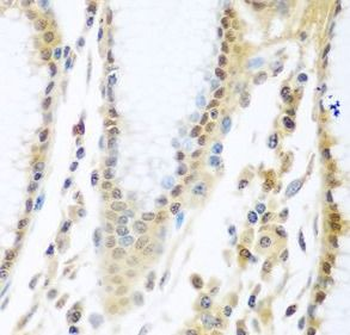 MYBBP1A Antibody
