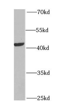 MYCN Rabbit Polyclonal Antibody