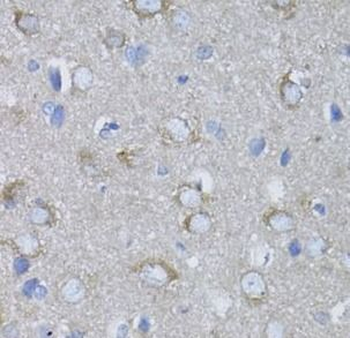 MYH10 Antibody
