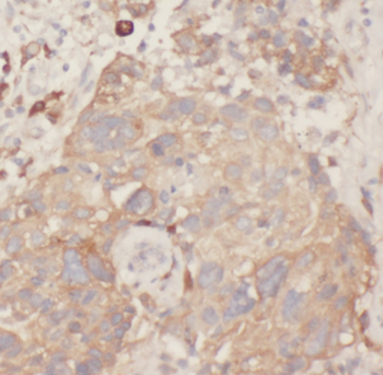MYH9 Antibody