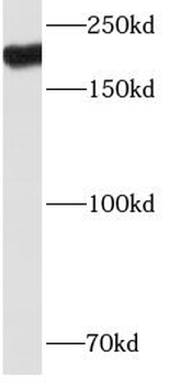 MYH9 Mouse Monoclonal Antibody