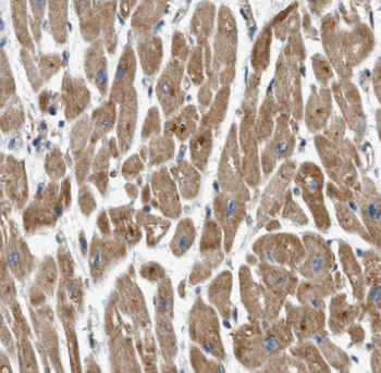 MYL12A Antibody