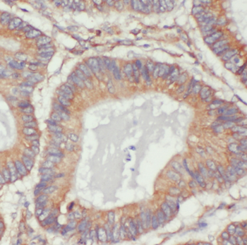 MYL9 Antibody