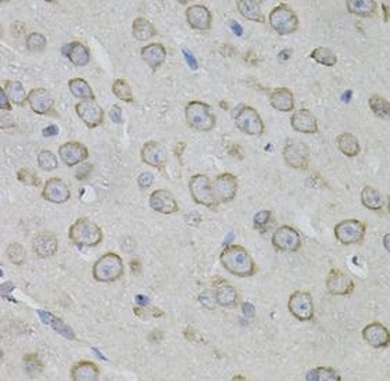 MYO10 Antibody