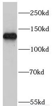 MYO1A Rabbit Polyclonal Antibody