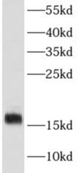 MB Mouse Monoclonal Antibody